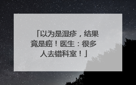 以为是湿疹，结果竟是癌！医生：很多人去错科室！