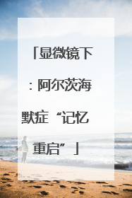 显微镜下：阿尔茨海默症“记忆重启”